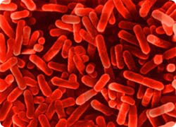 Legionella